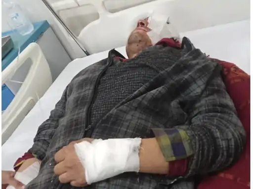भालू के हमले से एक व्यक्ति गंभीर घायल , कुल्लू अस्पताल से PGI चंडीगढ़ रेफर